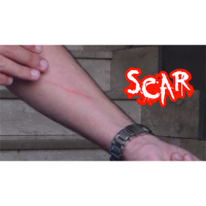 SCAR by Dan Alex – Video DOWNLOAD